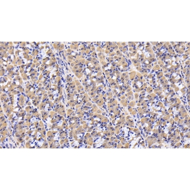 Sequestosome 1 (SQSTM1) Human Monoclonal Antibody
