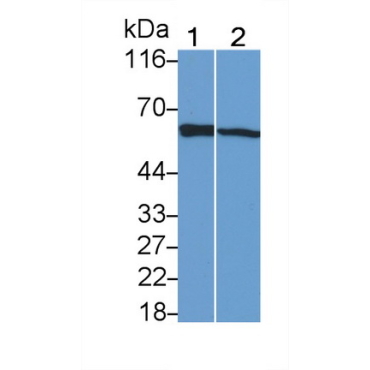 Sequestosome 1 (SQSTM1) Human Monoclonal Antibody