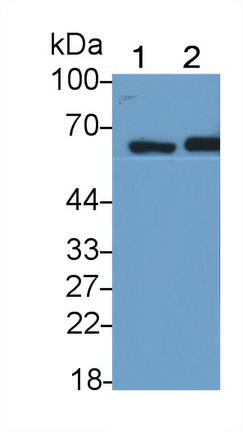 Sequestosome 1 (SQSTM1) Human Monoclonal Antibody
