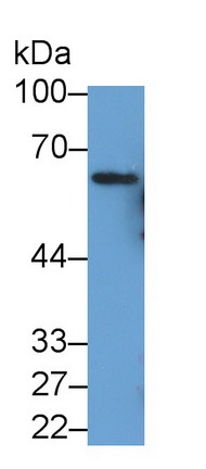 Sequestosome 1 (SQSTM1) Human Monoclonal Antibody