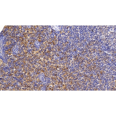 Sequestosome 1 (SQSTM1) Human Monoclonal Antibody