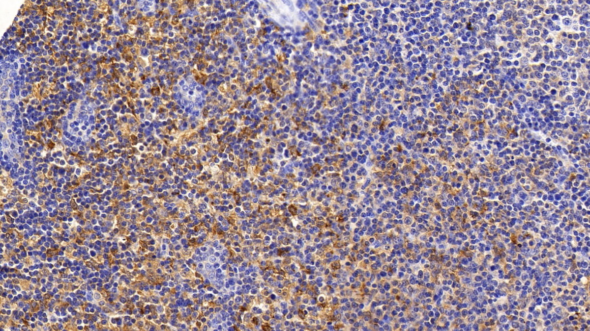 Sequestosome 1 (SQSTM1) Human Monoclonal Antibody