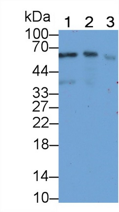 Sequestosome 1 (SQSTM1) Human Monoclonal Antibody