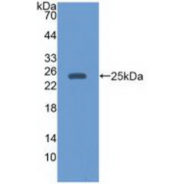 Epstein Barr Virus Induced Protein 3 (EBI3) Human Monoclonal Antibody
