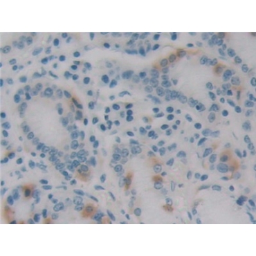 Epstein Barr Virus Induced Protein 3 (EBI3) Human Monoclonal Antibody
