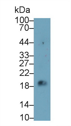 Chorionic Gonadotropin Beta Polypeptide (CGb) Human Monoclonal Antibody