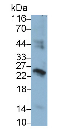 Chorionic Gonadotropin Beta Polypeptide (CGb) Human Monoclonal Antibody
