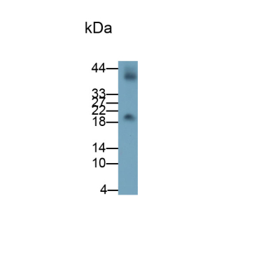 Chorionic Gonadotropin Beta Polypeptide (CGb) Human Monoclonal Antibody