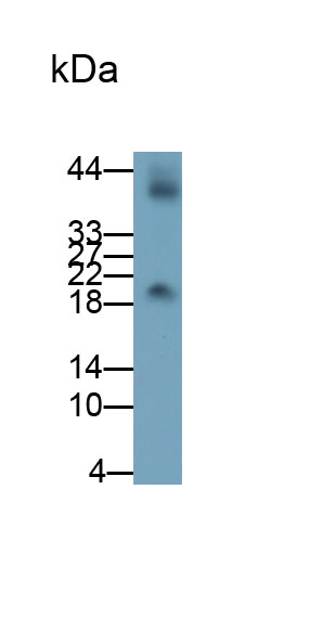 Chorionic Gonadotropin Beta Polypeptide (CGb) Human Monoclonal Antibody