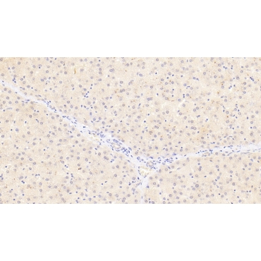 Lipase, Monoacylglycerol (MGL) Human Monoclonal Antibody