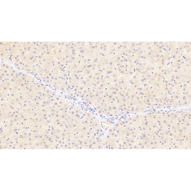 Lipase, Monoacylglycerol (MGL) Human Monoclonal Antibody