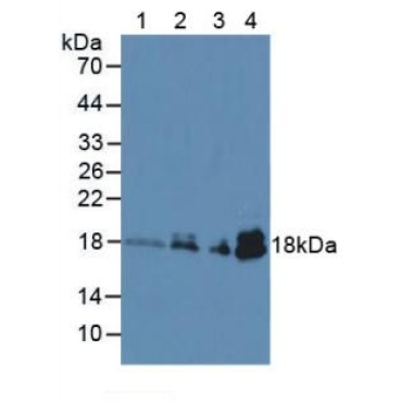 Troponin C Type 1, Slow (TNNC1) Human Monoclonal Antibody