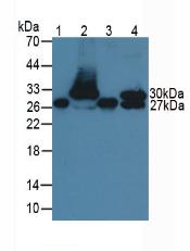 Troponin I Type 1, Slow Skeletal (TNNI1) Rat Monoclonal Antibody