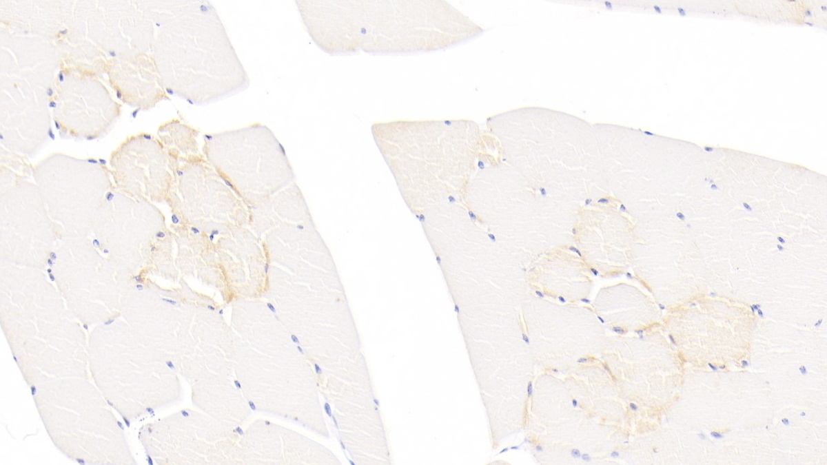 Troponin T Type 2, Cardiac (TNNT2) Human Monoclonal Antibody