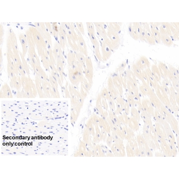 Troponin T Type 2, Cardiac (TNNT2) Human Monoclonal Antibody