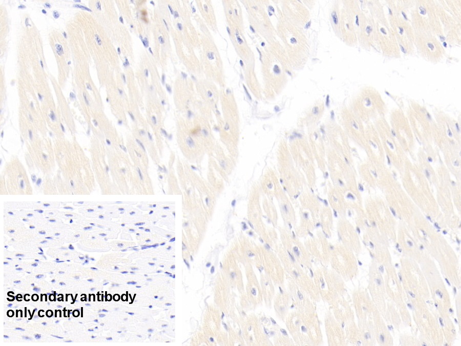 Troponin T Type 2, Cardiac (TNNT2) Human Monoclonal Antibody