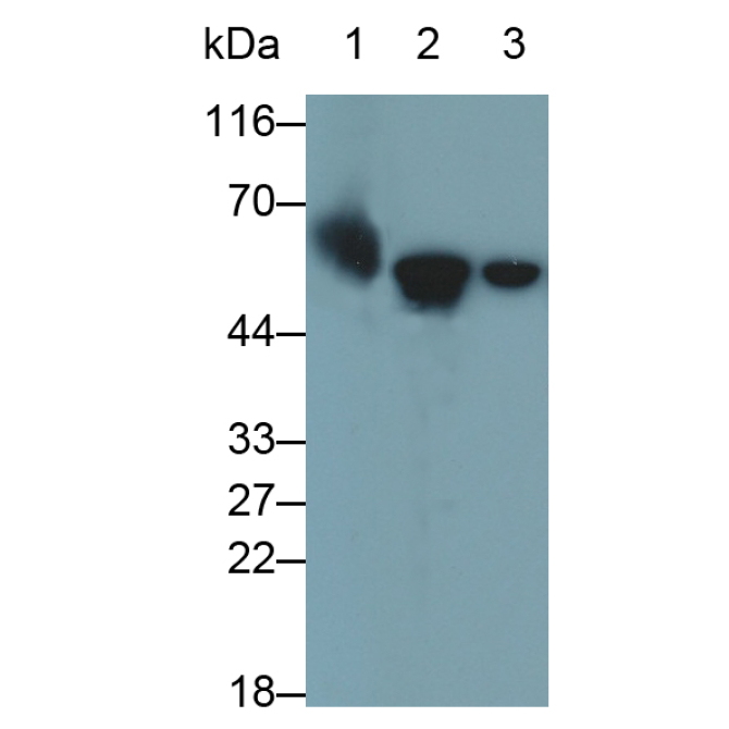 Keratin 6A (KRT6A) Human Monoclonal Antibody