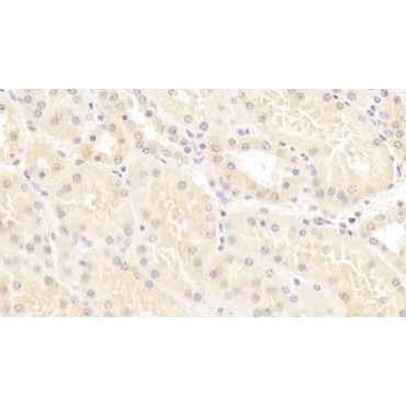 Amiloride Sensitive Sodium Channel Subunit Gamma (SCNN1g) Human Monoclonal Antibody