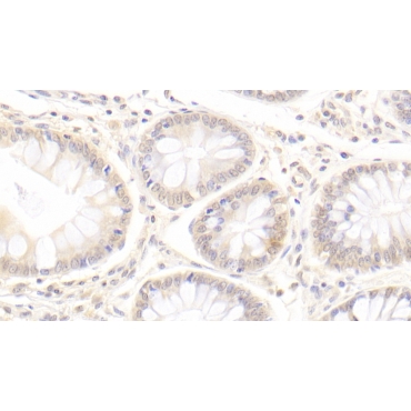 Amiloride Sensitive Sodium Channel Subunit Gamma (SCNN1g) Human Monoclonal Antibody