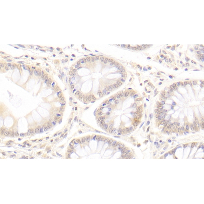 Amiloride Sensitive Sodium Channel Subunit Gamma (SCNN1g) Human Monoclonal Antibody
