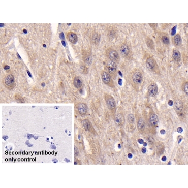 Casein Kinase 1 Delta (CSNK1d) Human Monoclonal Antibody