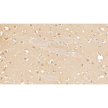 Casein Kinase 1 Delta (CSNK1d) Human Monoclonal Antibody