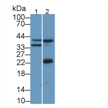 Apolipoprotein L2 (APOL2) Human Monoclonal Antibody