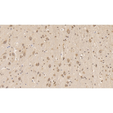 Apolipoprotein L2 (APOL2) Human Monoclonal Antibody