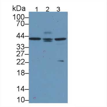Apolipoprotein L2 (APOL2) Human Monoclonal Antibody