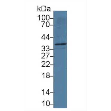 Apolipoprotein L2 (APOL2) Human Monoclonal Antibody