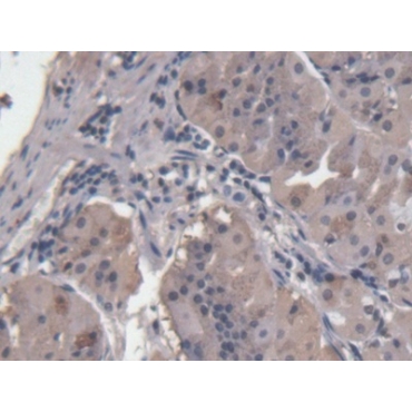 Heat Shock Protein 90kDa Alpha B1 (HSP90aB1) Human Monoclonal Antibody