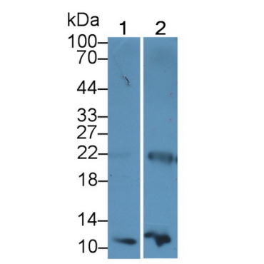 Diazepam Binding Inhibitor (DBI) Human Monoclonal Antibody