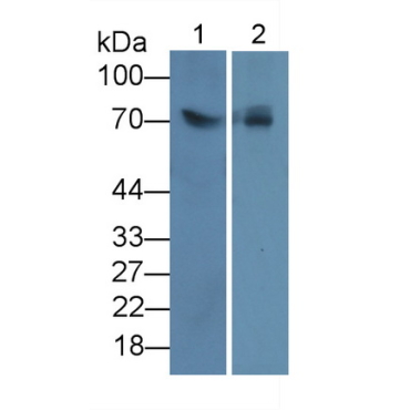 Lipolysis Stimulated Lipoprotein Receptor (LSR) Human Monoclonal Antibody