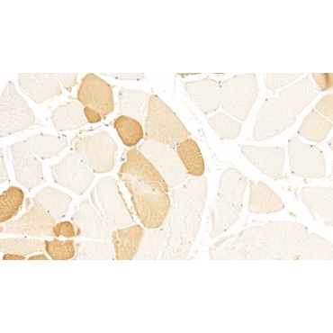 Lipolysis Stimulated Lipoprotein Receptor (LSR) Human Monoclonal Antibody