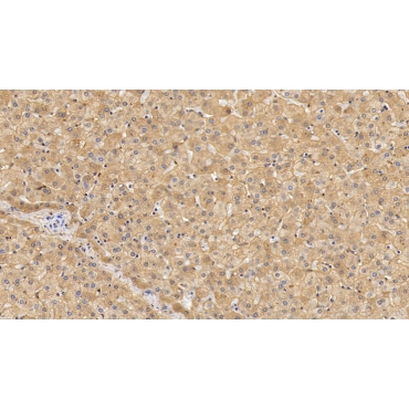 Lipolysis Stimulated Lipoprotein Receptor (LSR) Human Monoclonal Antibody