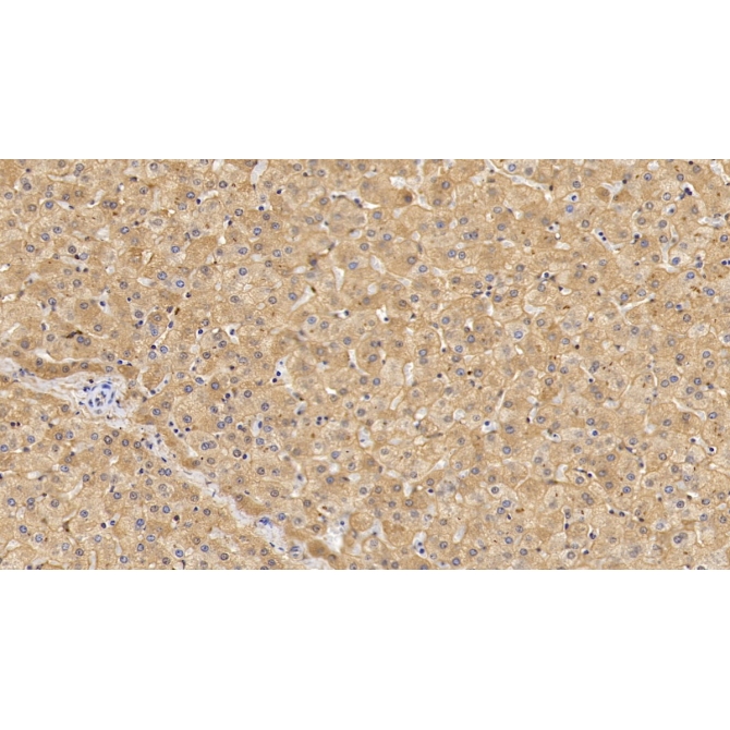 Lipolysis Stimulated Lipoprotein Receptor (LSR) Human Monoclonal Antibody