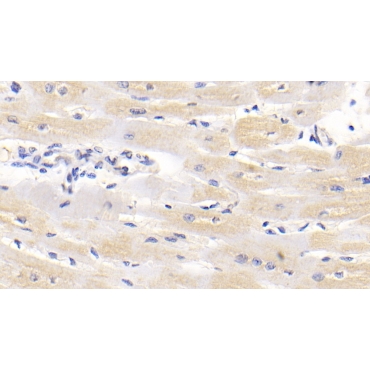 Lipolysis Stimulated Lipoprotein Receptor (LSR) Human Monoclonal Antibody