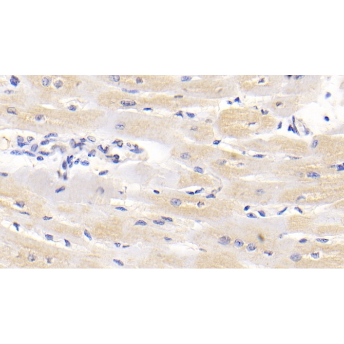 Lipolysis Stimulated Lipoprotein Receptor (LSR) Human Monoclonal Antibody