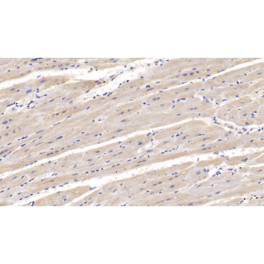 Lipolysis Stimulated Lipoprotein Receptor (LSR) Human Monoclonal Antibody