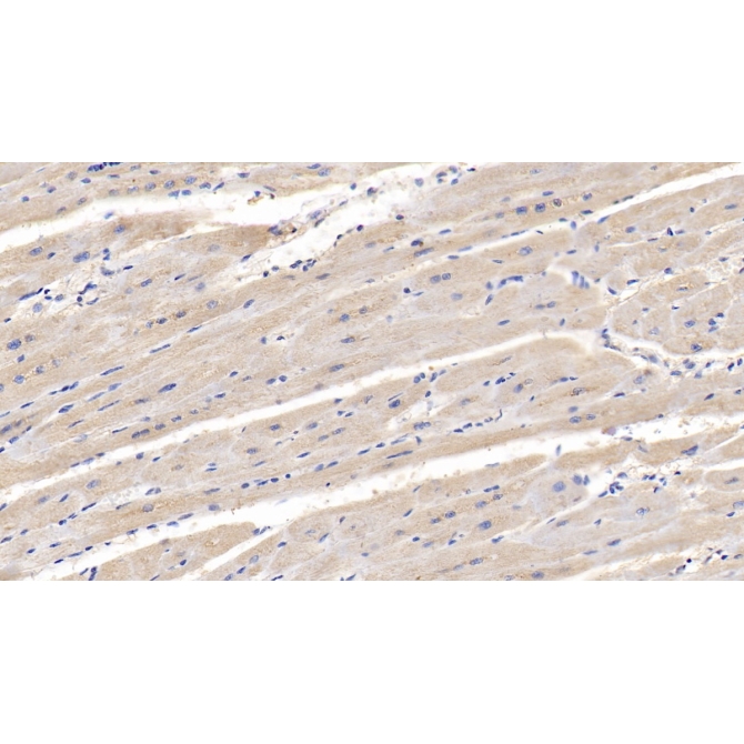 Lipolysis Stimulated Lipoprotein Receptor (LSR) Human Monoclonal Antibody