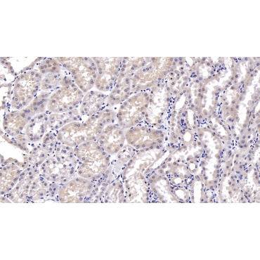 Deoxythymidylate Kinase (DTYMK) Mouse Monoclonal Antibody