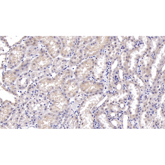 Deoxythymidylate Kinase (DTYMK) Mouse Monoclonal Antibody