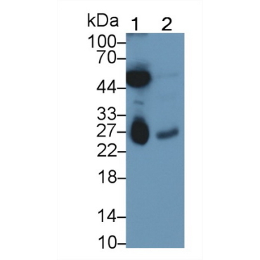 Deoxythymidylate Kinase (DTYMK) Mouse Monoclonal Antibody