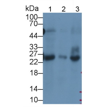 Deoxythymidylate Kinase (DTYMK) Mouse Monoclonal Antibody