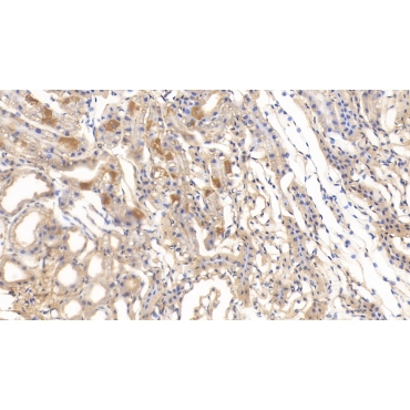 Deoxythymidylate Kinase (DTYMK) Mouse Monoclonal Antibody