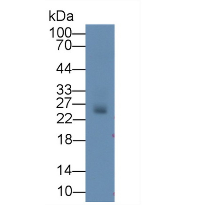 Deoxythymidylate Kinase (DTYMK) Mouse Monoclonal Antibody