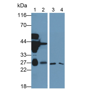 Deoxythymidylate Kinase (DTYMK) Mouse Monoclonal Antibody