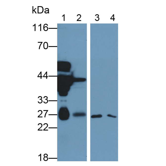 Deoxythymidylate Kinase (DTYMK) Mouse Monoclonal Antibody