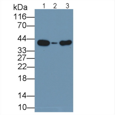 Arginase II (Arg2) Human Monoclonal Antibody