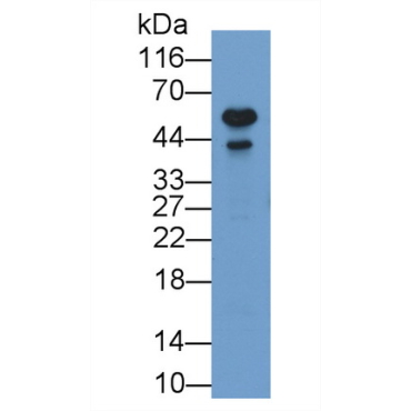 Arginase II (Arg2) Human Monoclonal Antibody